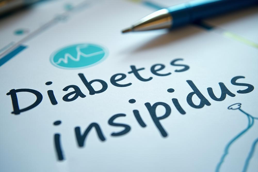 دیابت بیمز‌ه چیست؟